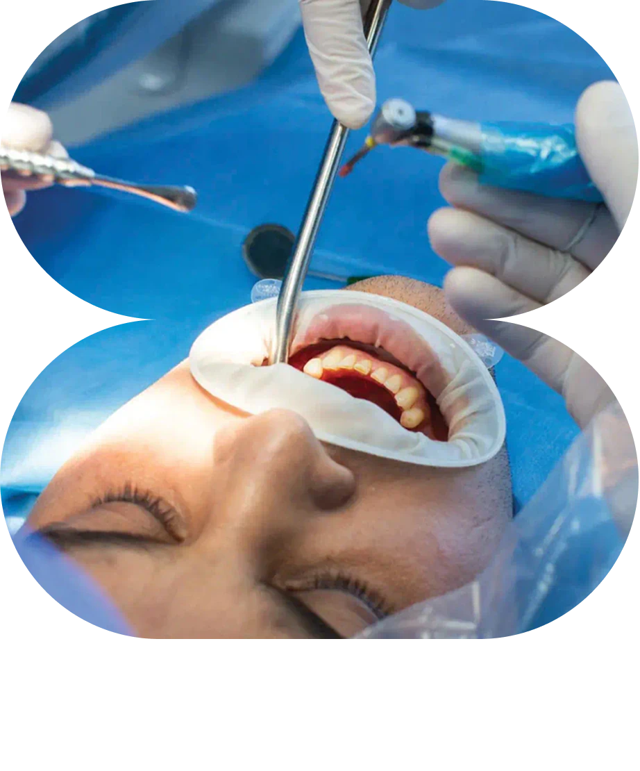 Advanced surgical dental procedures for long-term oral health