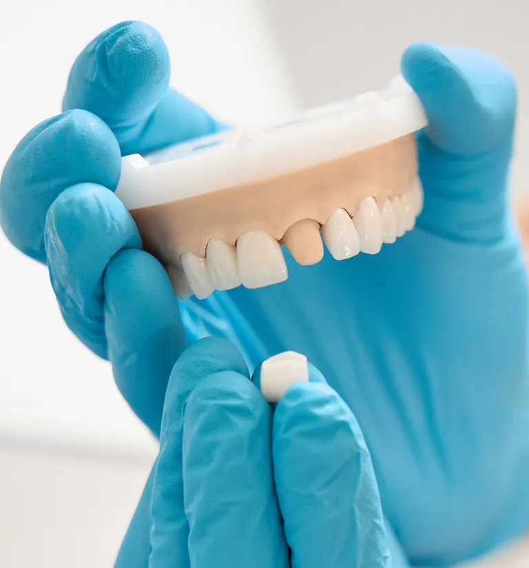 dental crown model
