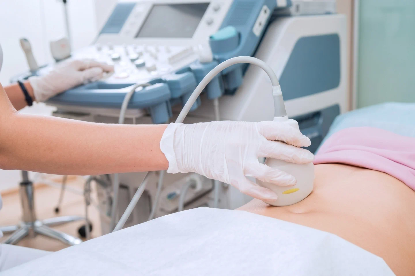 Ultrasound