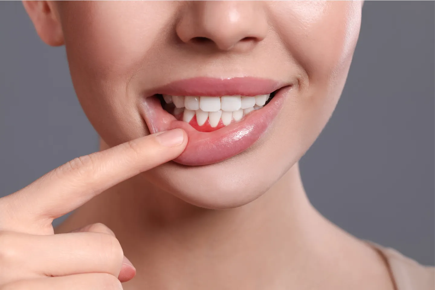 Gum disease treatment at Buford dental