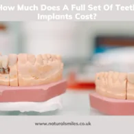How Much Does A Full Set Of Teeth Implants Cost?