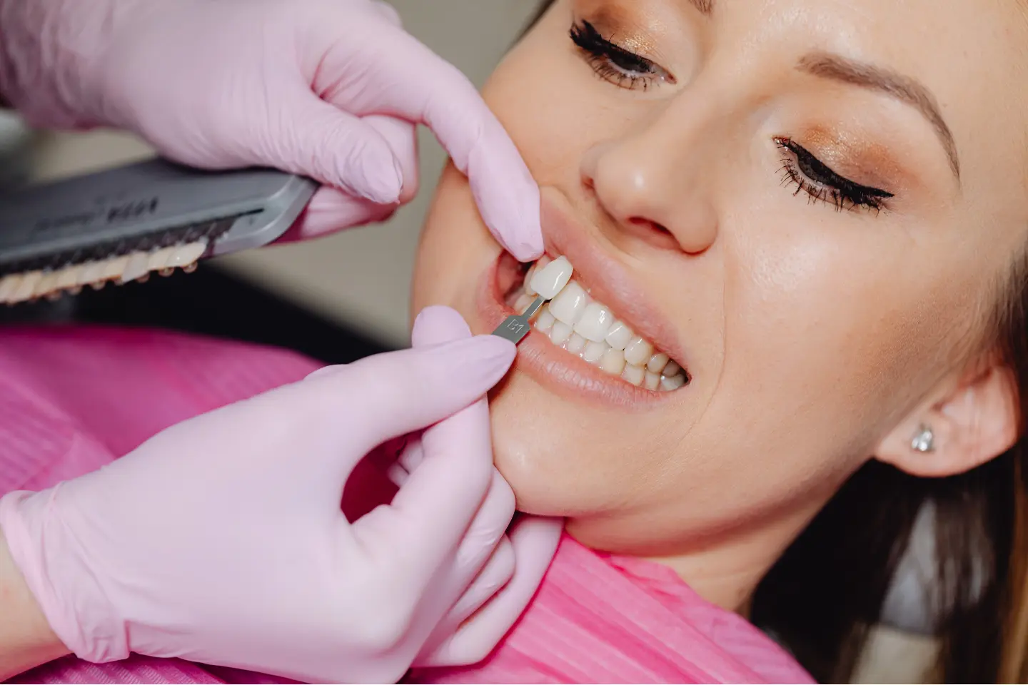 The Benefits of Dental Crowns and Veneers