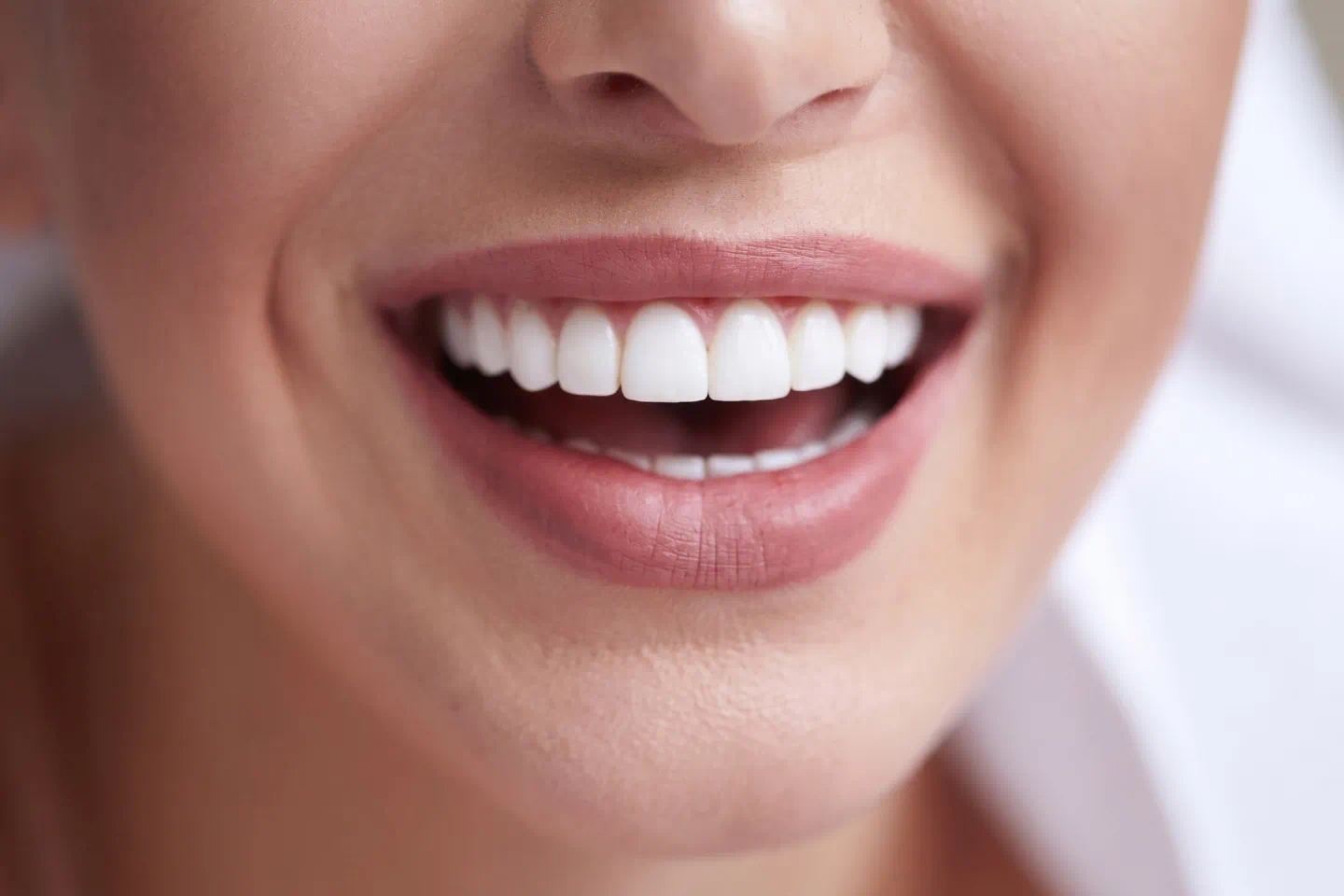 Dental Veneers in Ludlow, MA