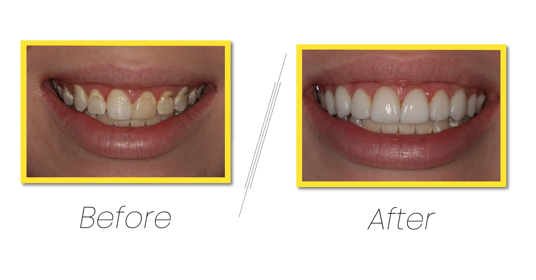 Explore our general & family dentistry in north quincy