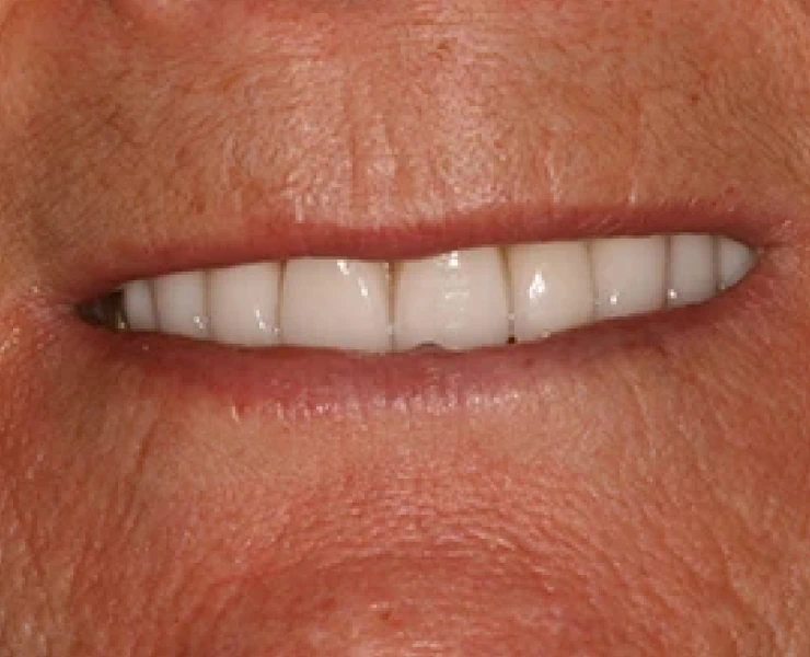 main-image