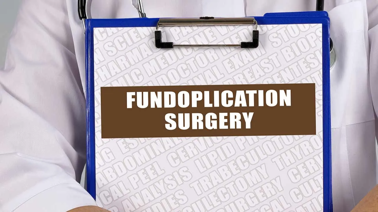 Fundoplication