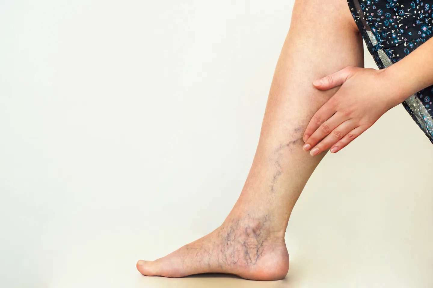 Specialist in Varicose Veins in Kharghar, Navi Mumbai