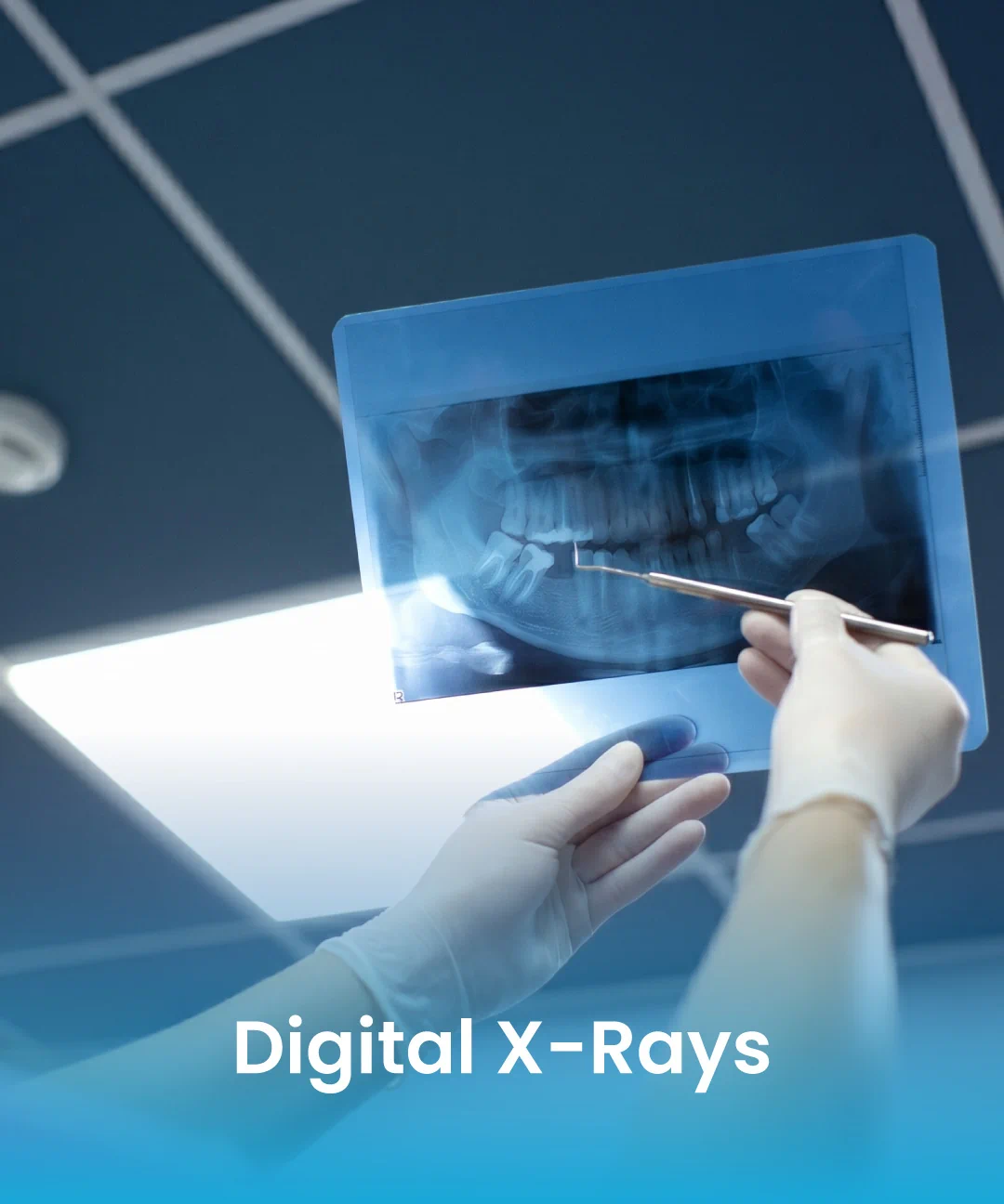 Digital dental X-ray examination