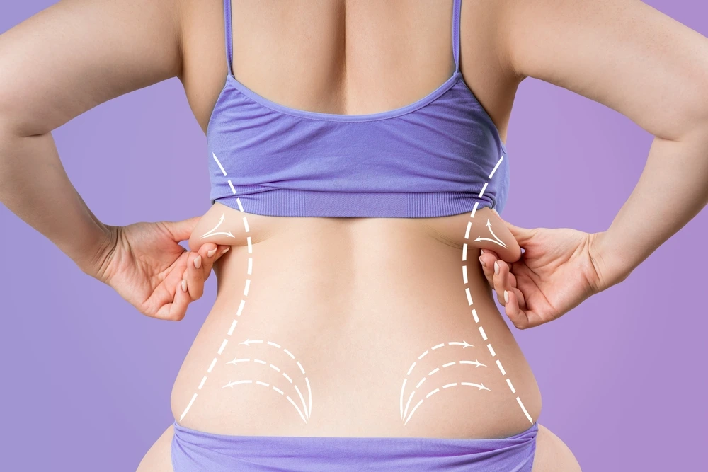 Icon showing a body silhouette with arrows indicating fat reduction and skin firming