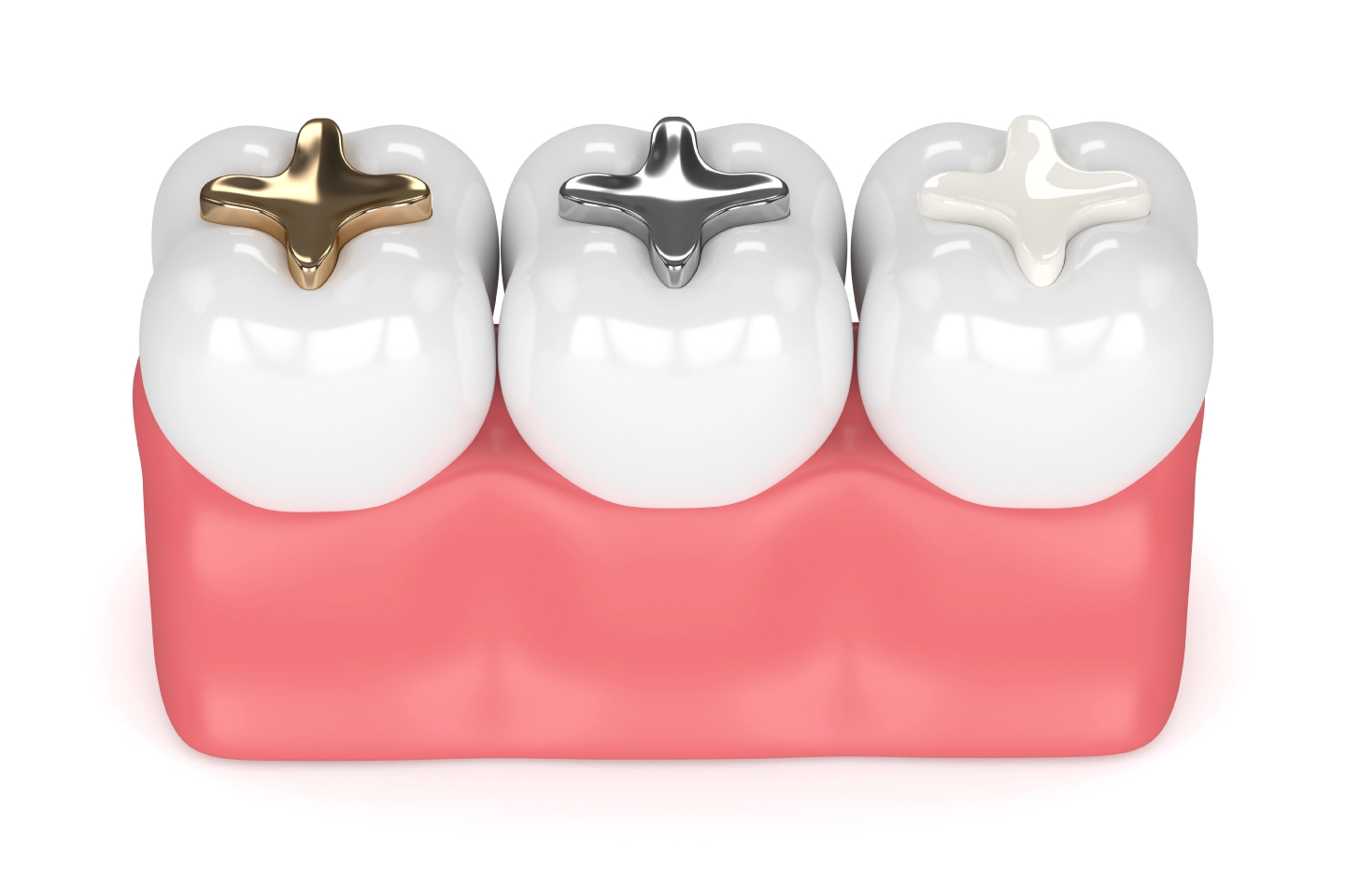 Advanced dental solutions at Add Smiles Dentistry