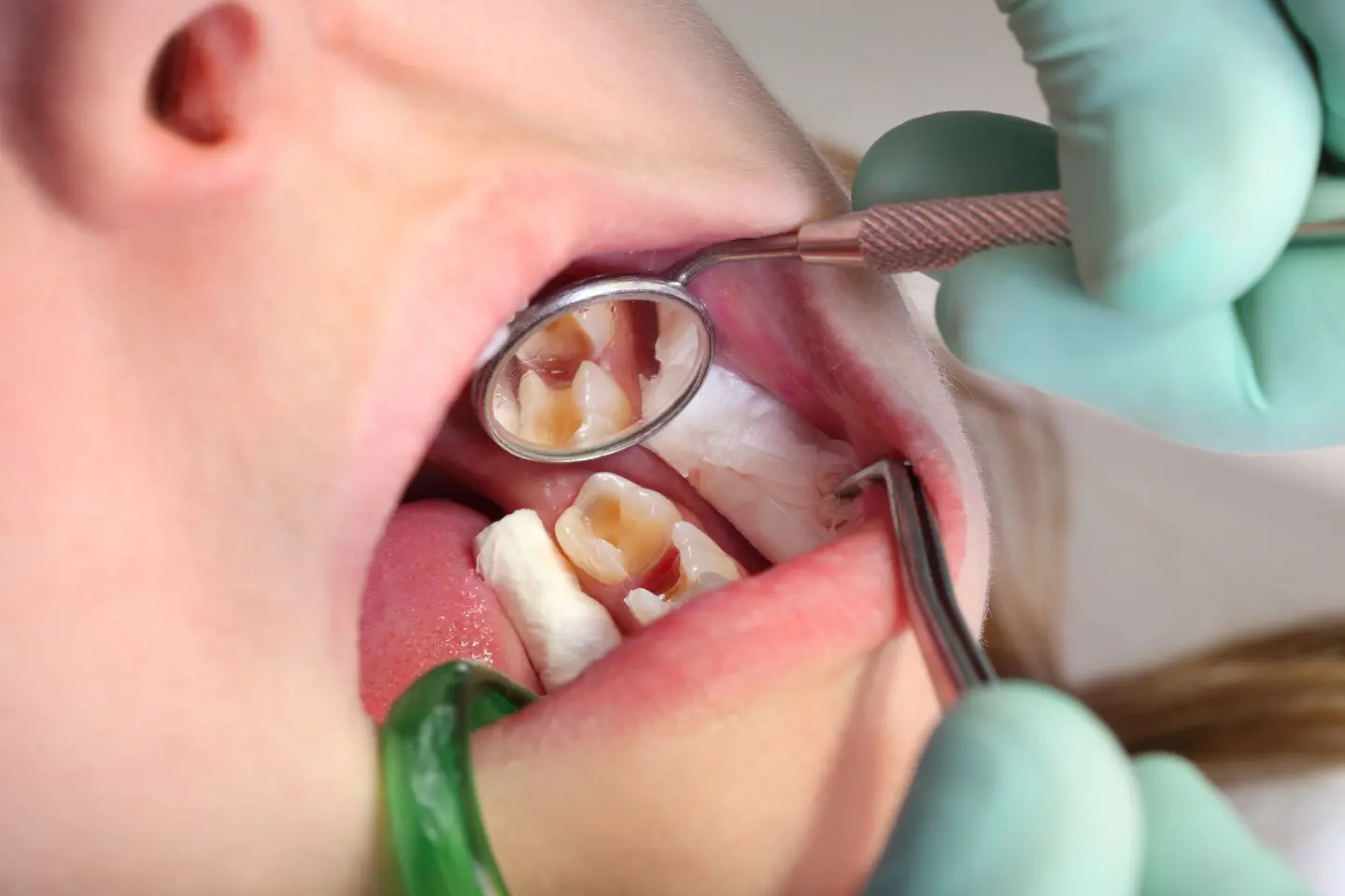What Your Teeth Say About Your Health