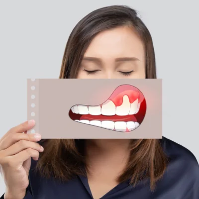 Gum Disease: Understanding the Causes, Consequences, and Prevention