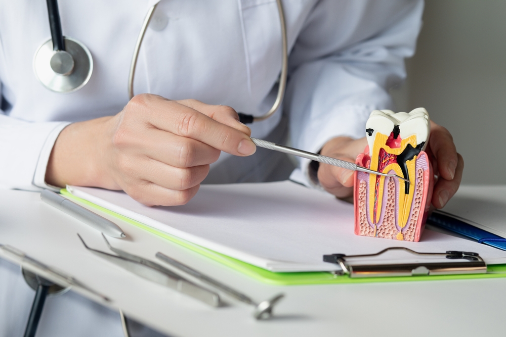 Root Canal Treatment