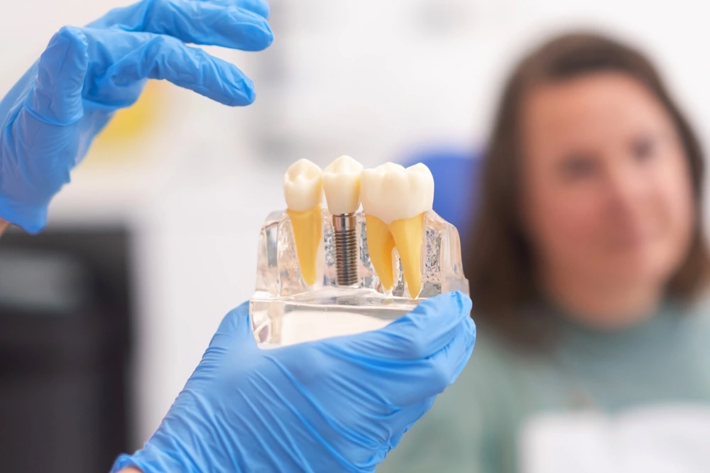 Dental Implants