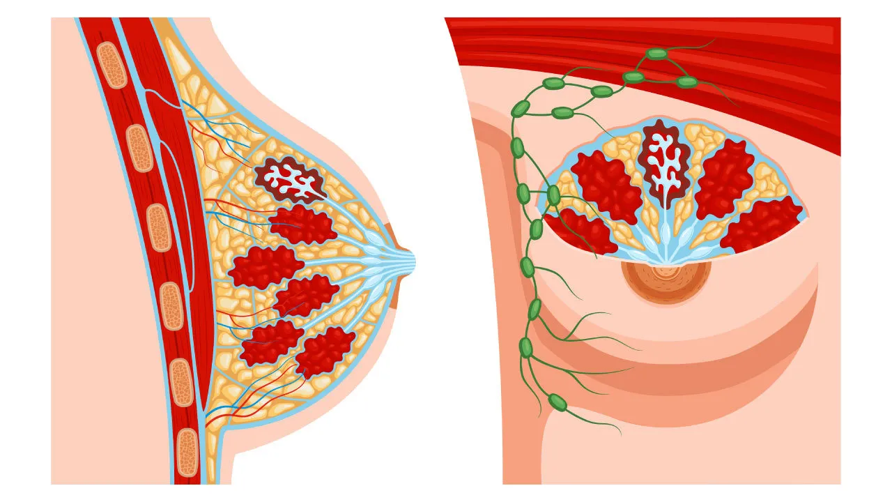 Breast Specialist Discussing Nipple Sparing Mastectomy and Reconstruction Options With a Patient