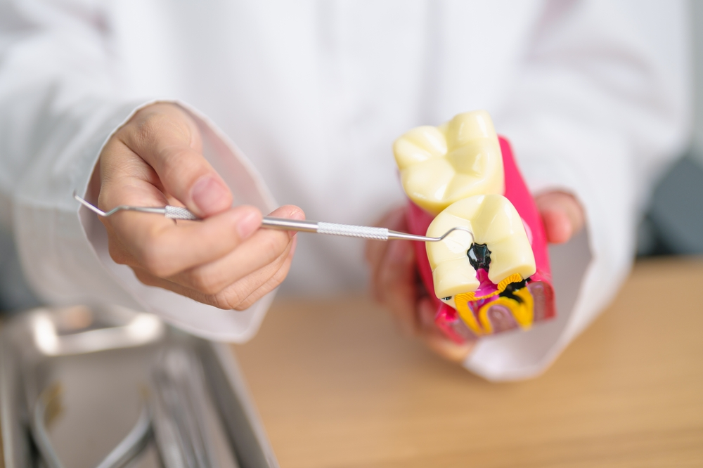 How to Prevent Cavities: 10 Expert Tips for Healthy Teeth