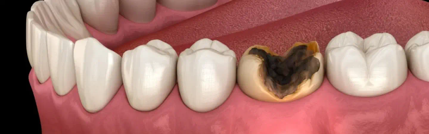 Abscess And Infection Treatment