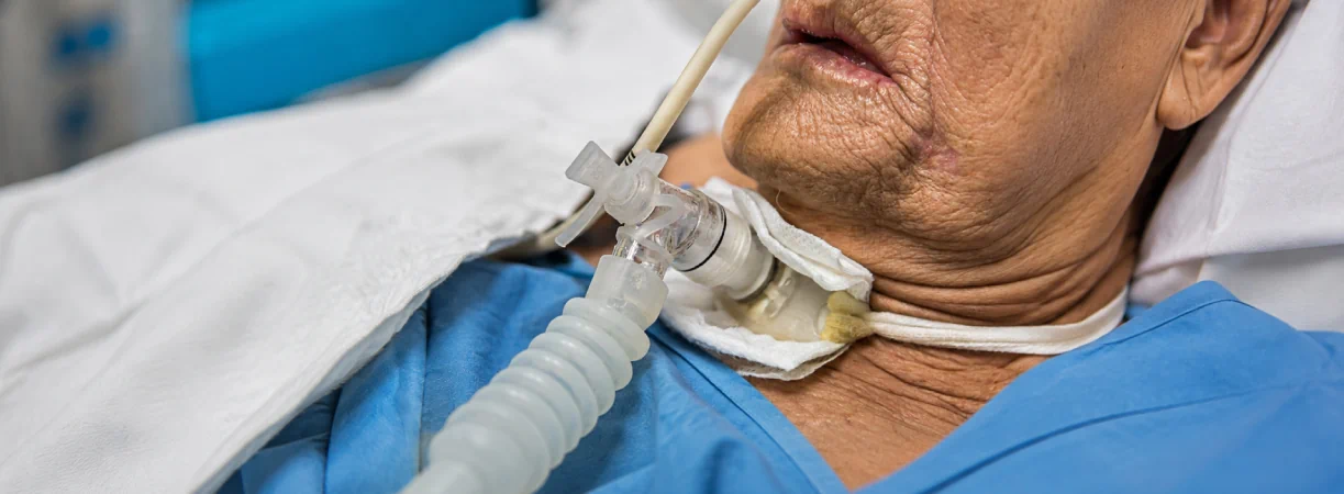 Tracheostomy