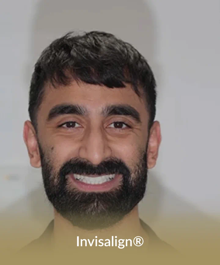Invisalign Card