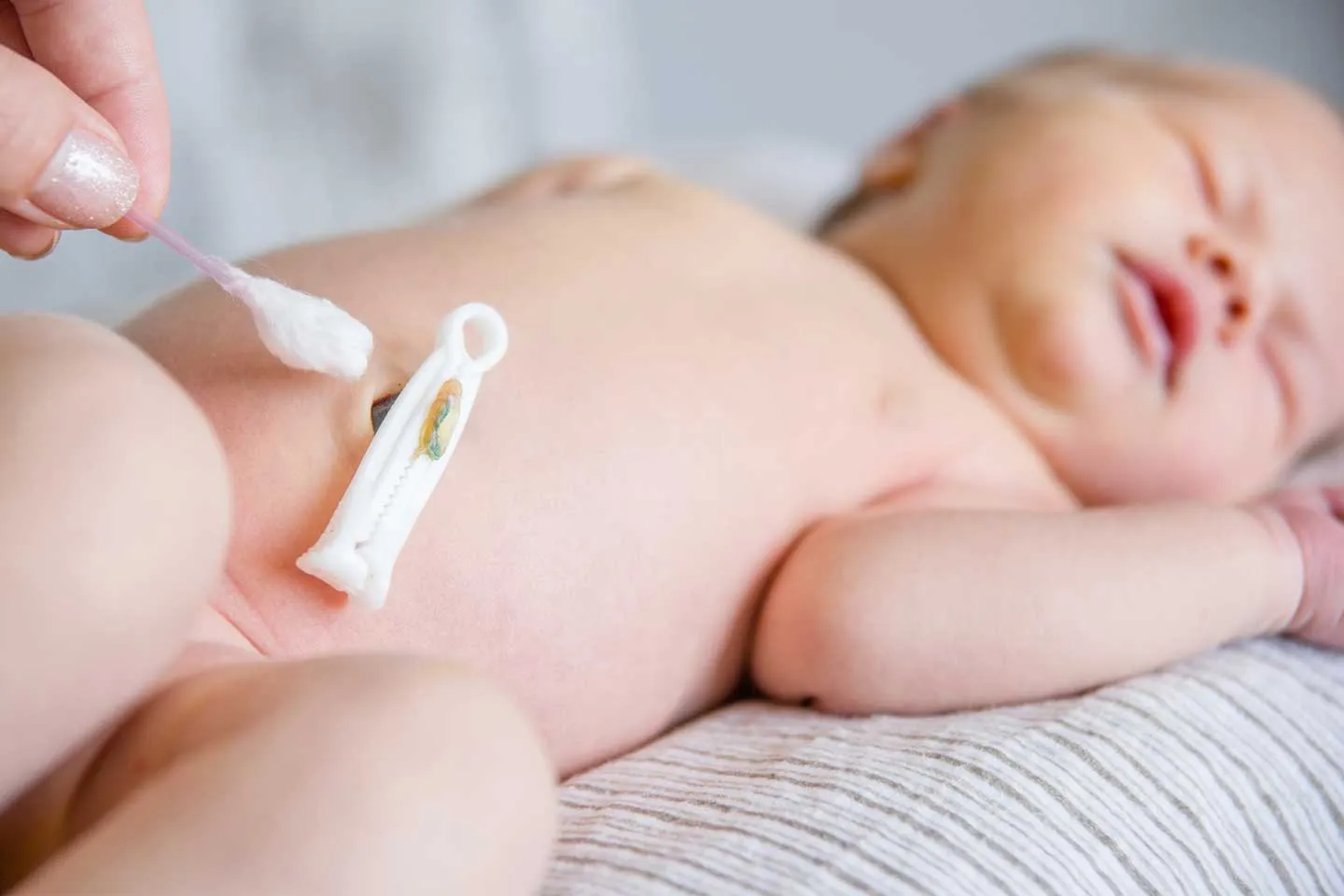 Belly Button Outie – Umbilical Hernia??