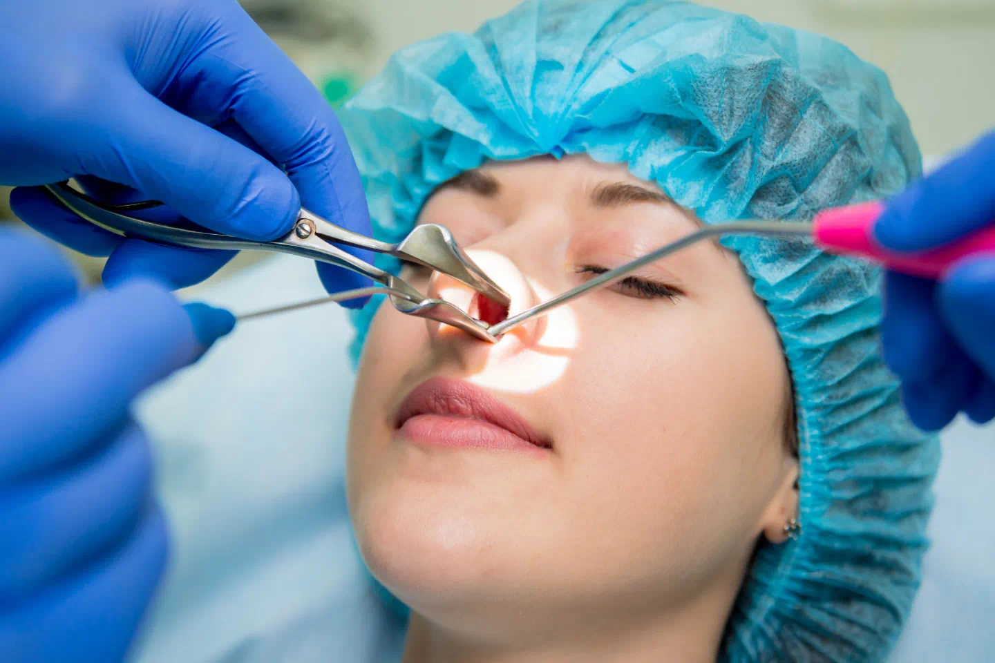 Functional Endoscopic Sinus Surgery (FESS)