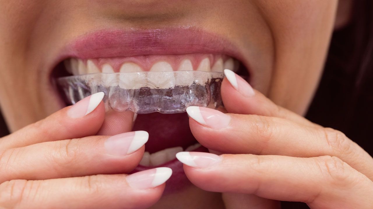 Invisalign in Henderson