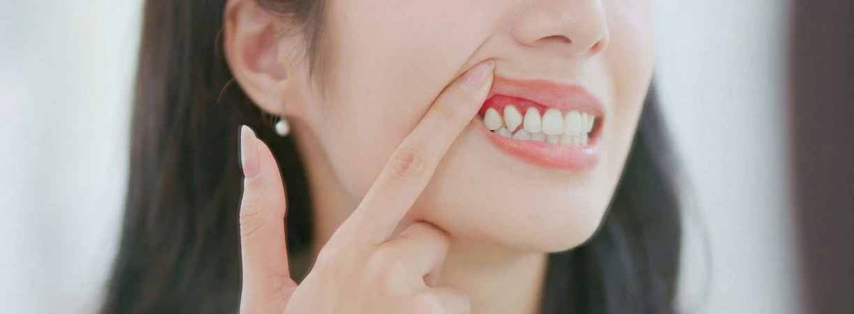 Periodontal Disease Management