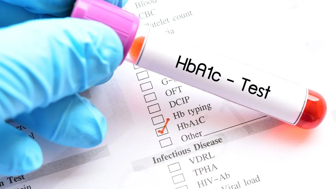 HbA1c blood test showing average blood sugar levels for diabetes monitoring