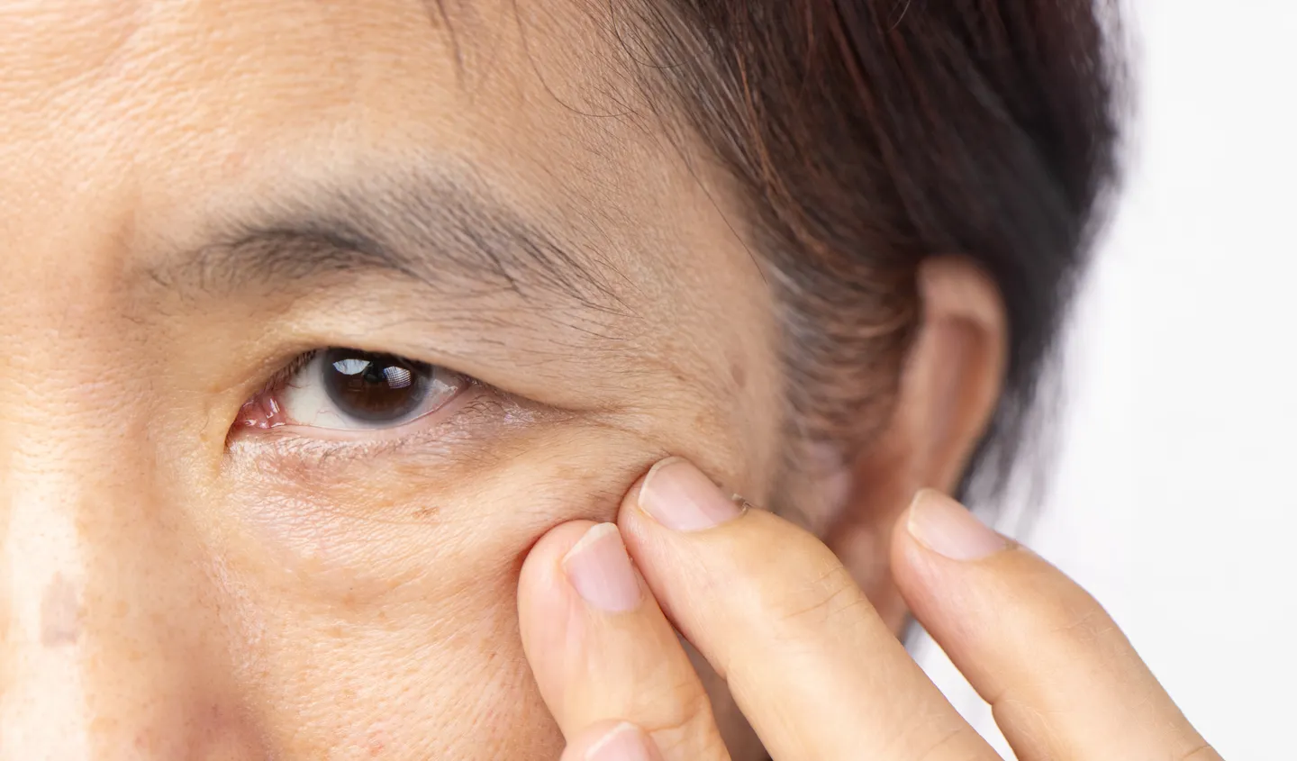 Surgeon examining patient’s eyelid