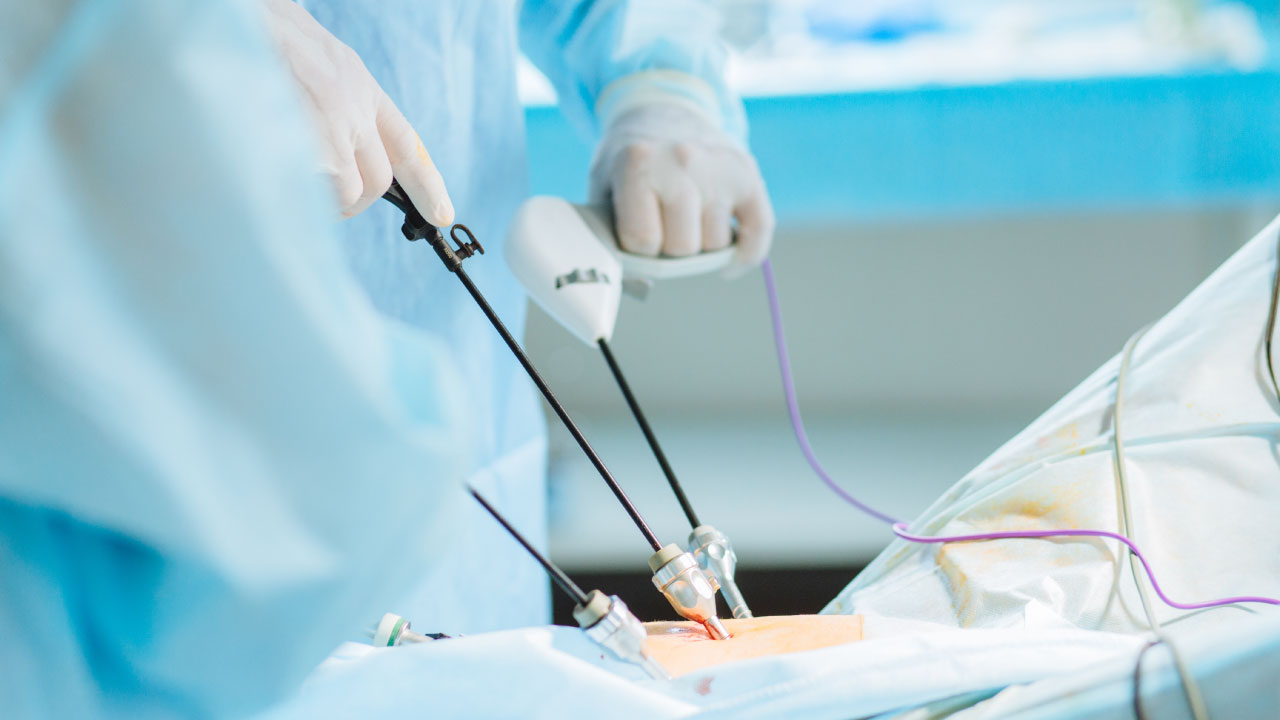 Abdominal Mass Biopsy Made Safer with Laparoscopy