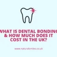 What Is Dental Bonding & How Much Does It Cost in the UK?