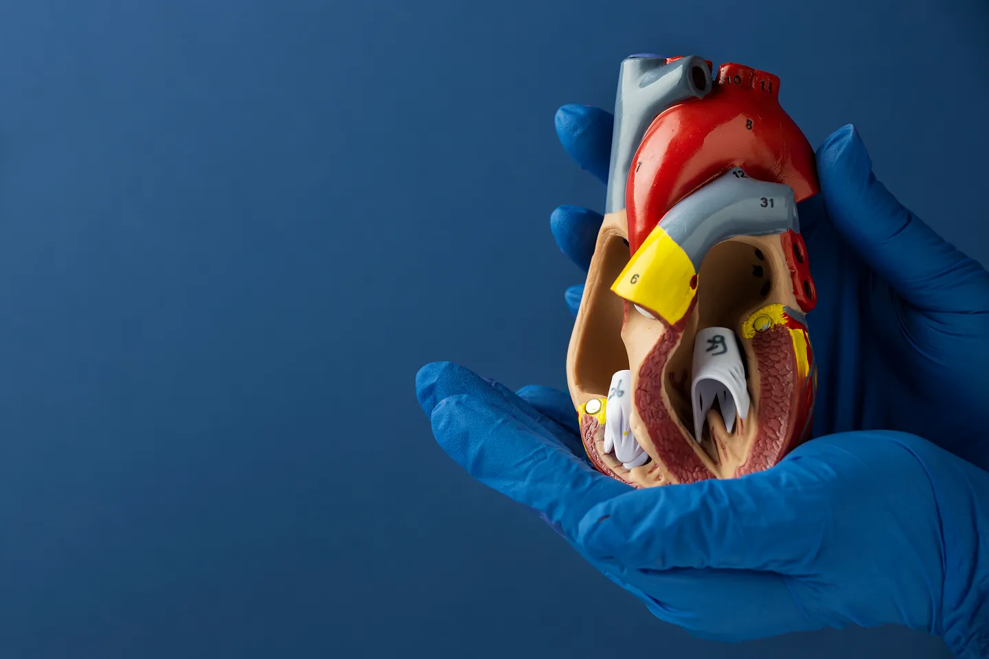 Structural Heart Interventions