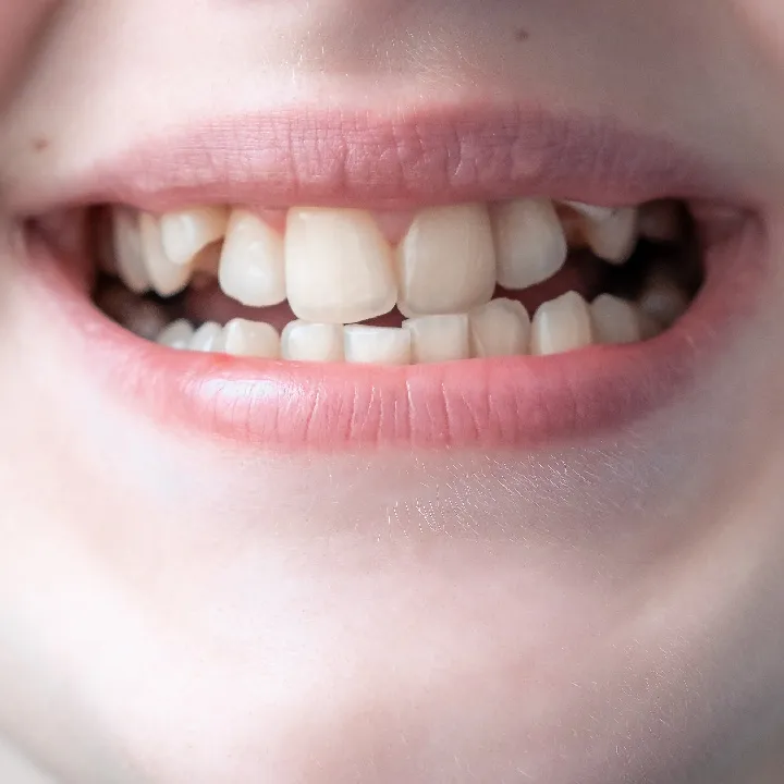 Orthodontist examining a child's teeth to assess bite alignment and jaw development