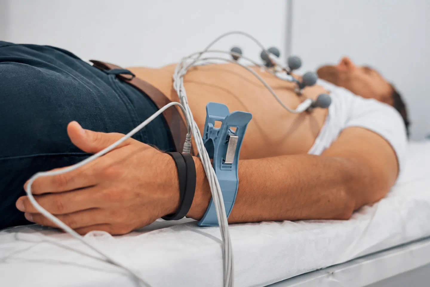 ECG