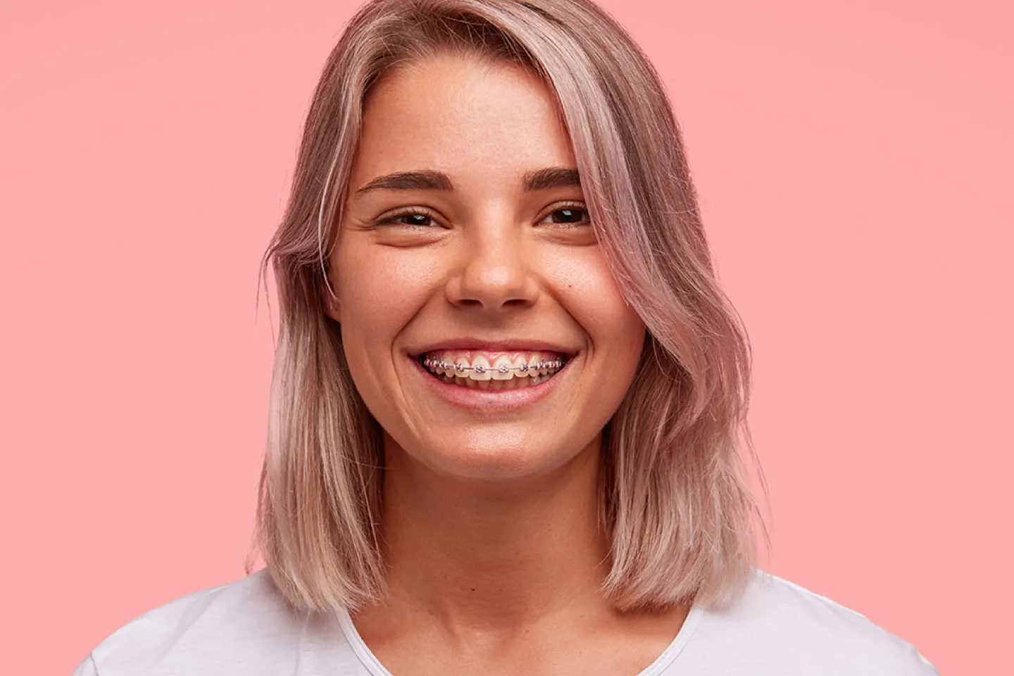 Adult Orthodontics: It's Never Too Late for a Perfect Smile