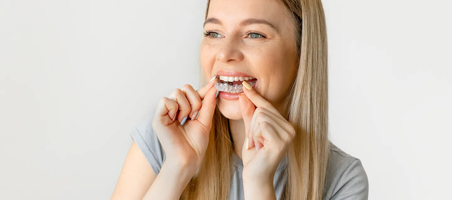 Clear Aligners vs. Braces: Which Is the Better Choice for Your Smile?