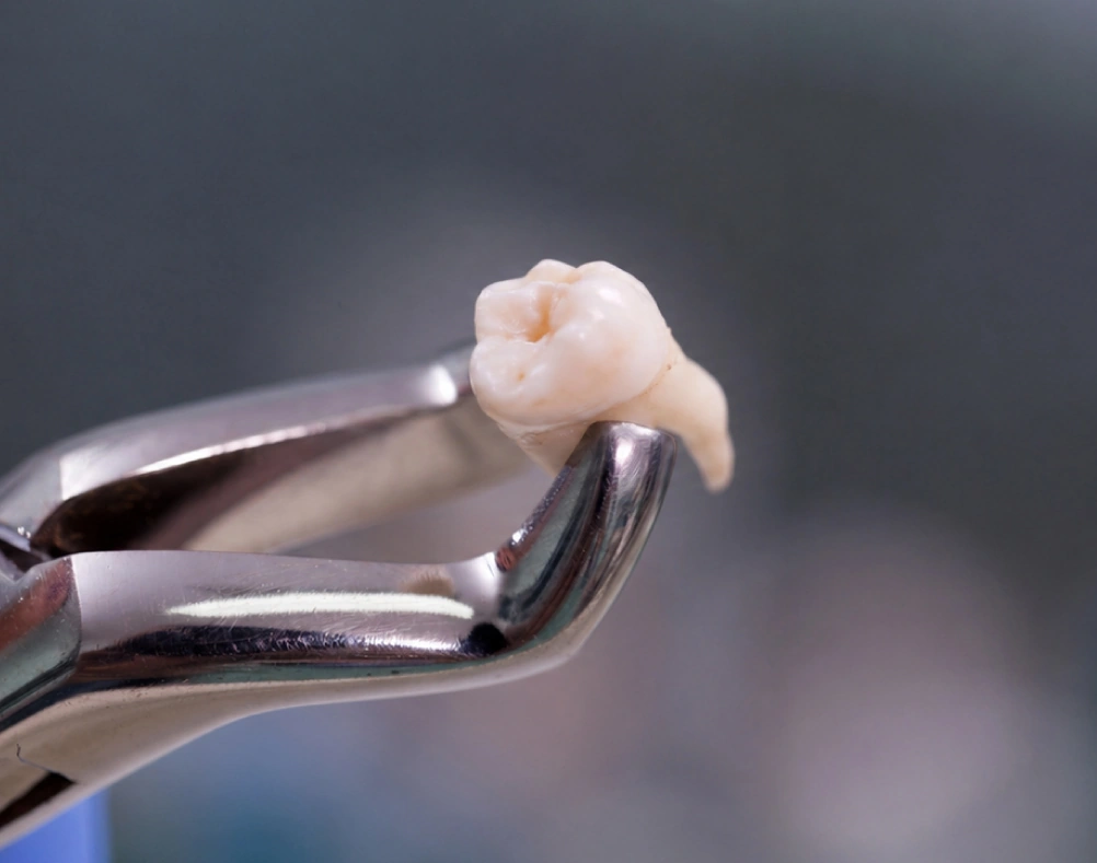 Oral Surgery
