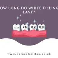 How Long Do White Fillings Last?