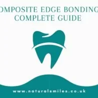 Composite Edge Bonding – Complete Guide