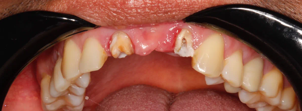 Emergency Dentist