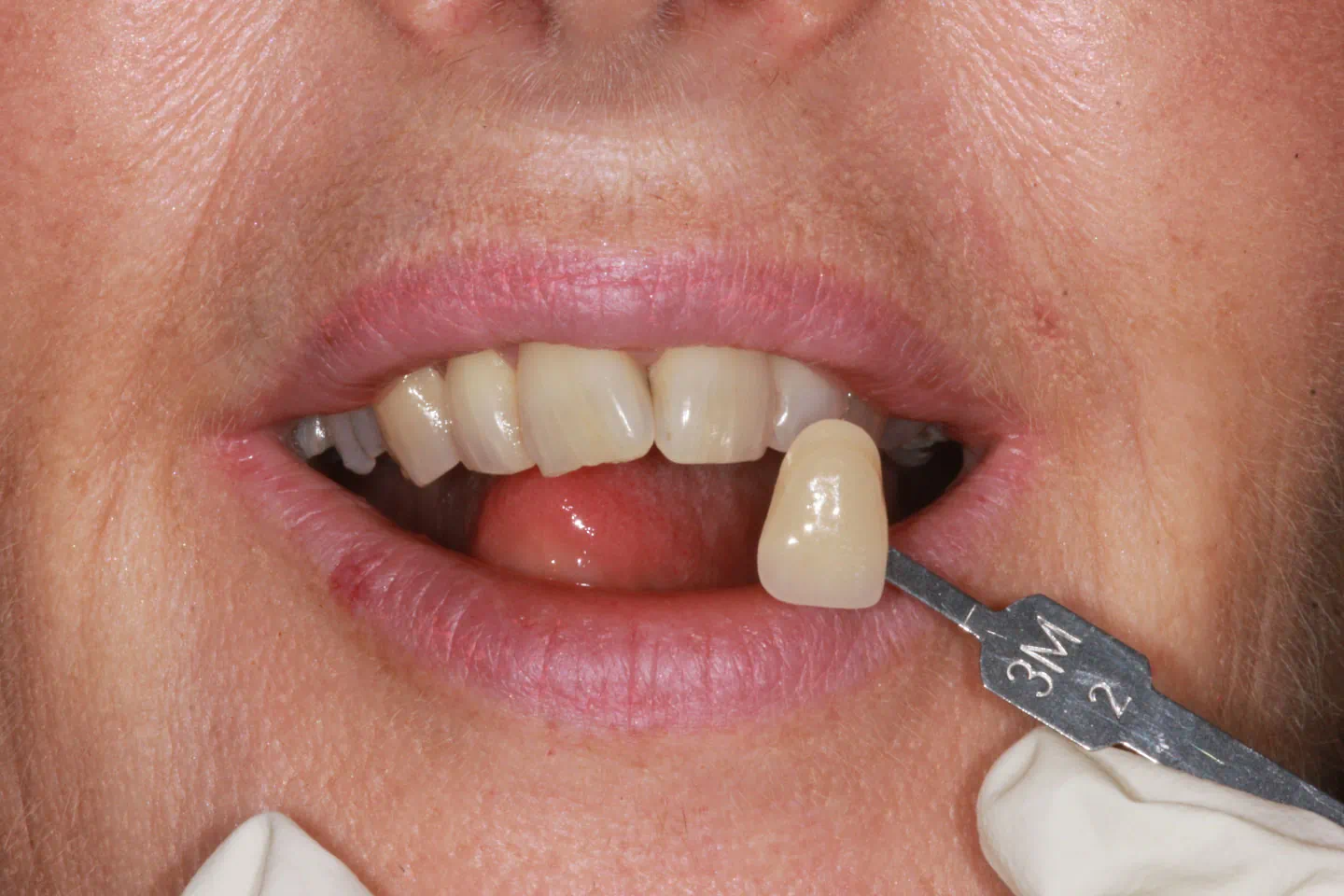 Cosmetic Dentistry