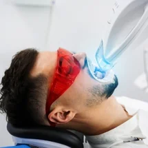 Teeth Whitening in Leicester and Corby: Why Choose a Professional Treatment Over DIY Kits?