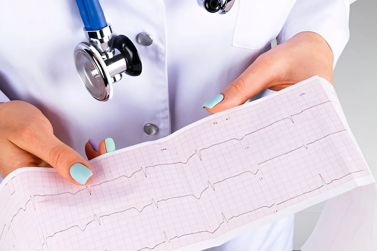 ECG (In-House)