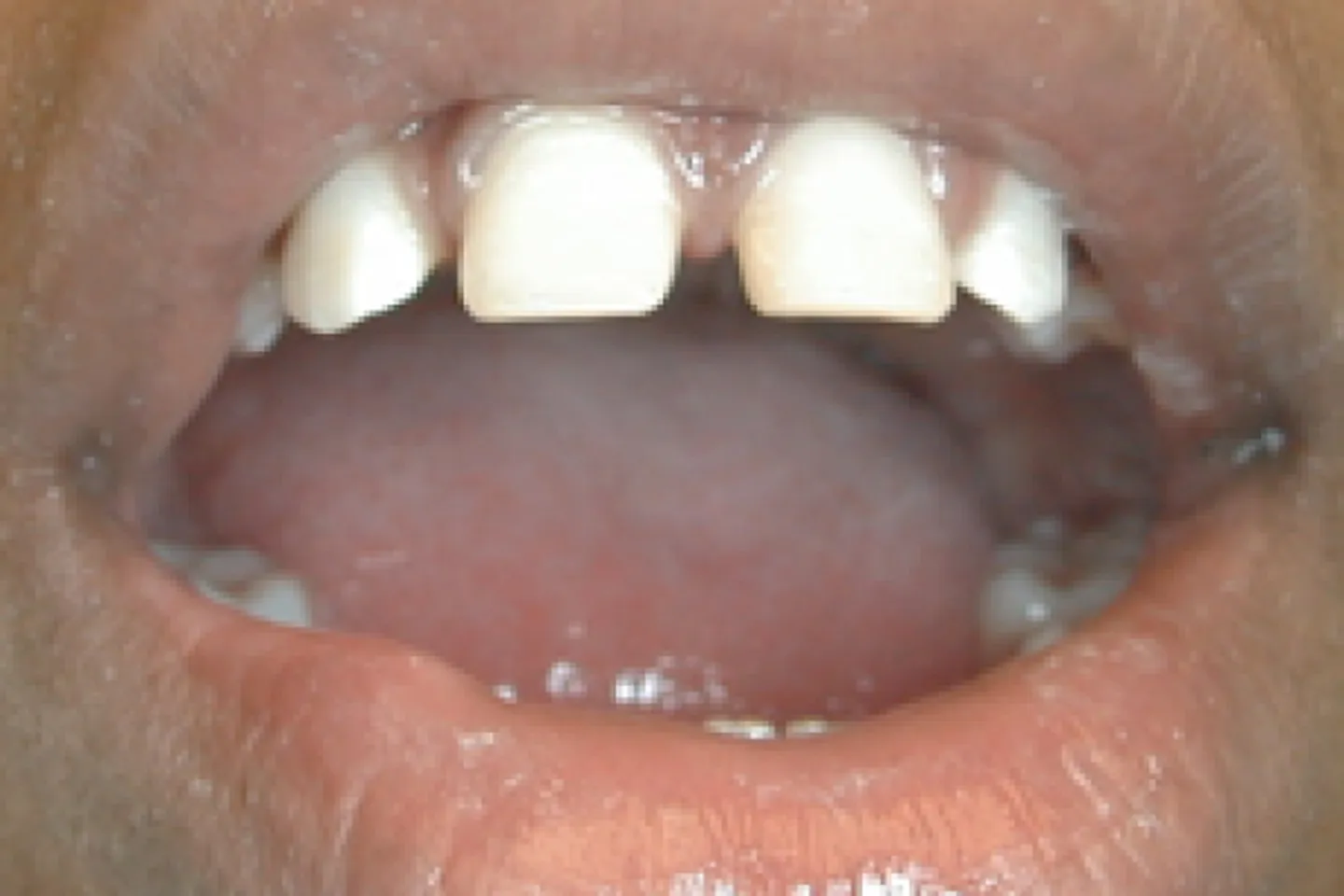 main-image