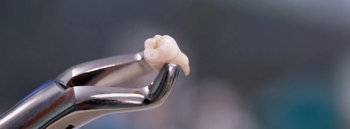 Oral Surgery