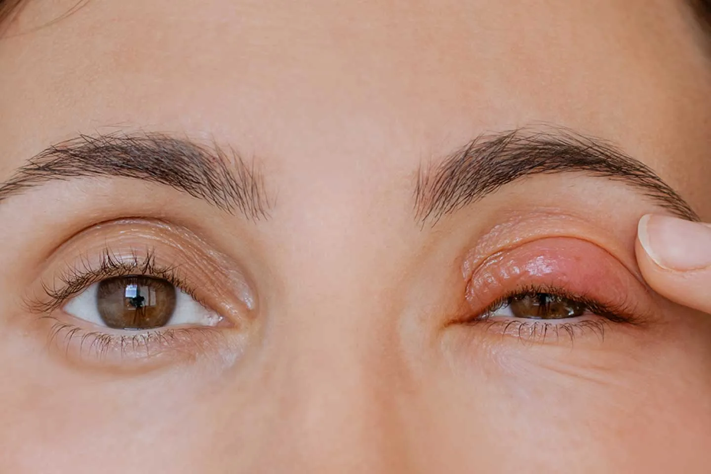 4 Eye Hygiene Practices That Reduce the Risk of Infection