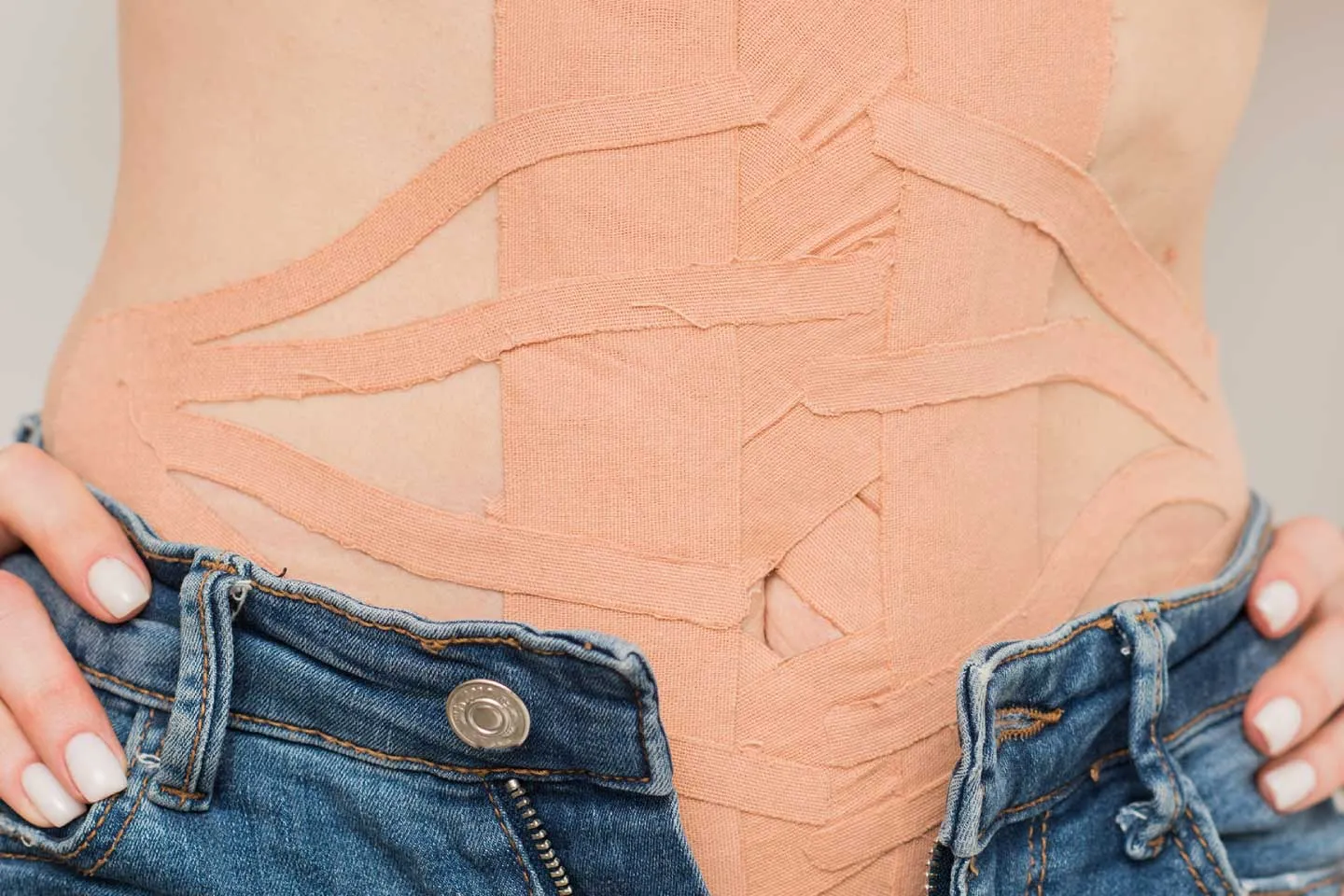 Diastasis Recti Correction