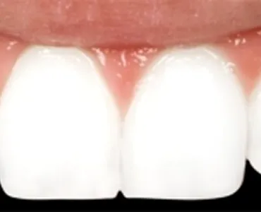 main-image