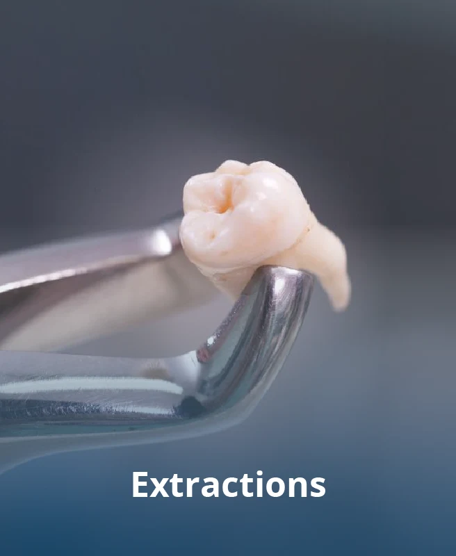 Extraction image