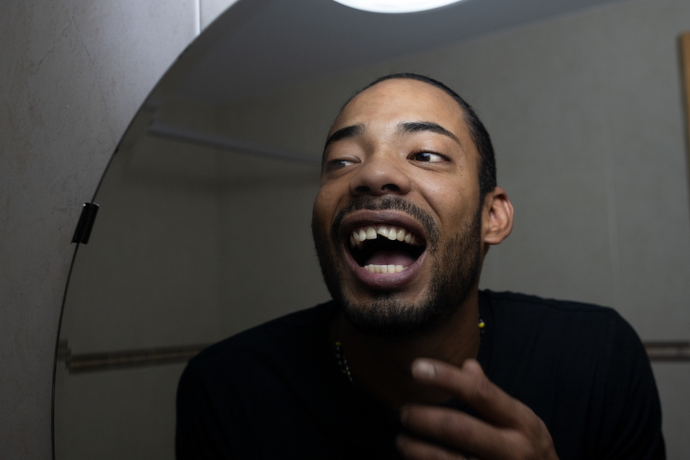 Broken or Chipped Tooth